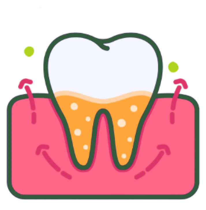 Periodoncia